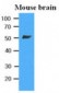 TUBB / Beta Tubulin Antibody (clone AT5B2)